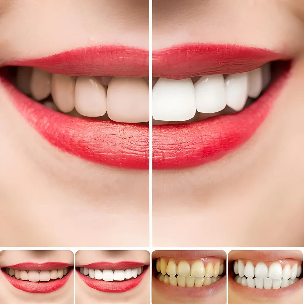 Probiotic Ultra Whitening Toothpaste (Pack of 2)